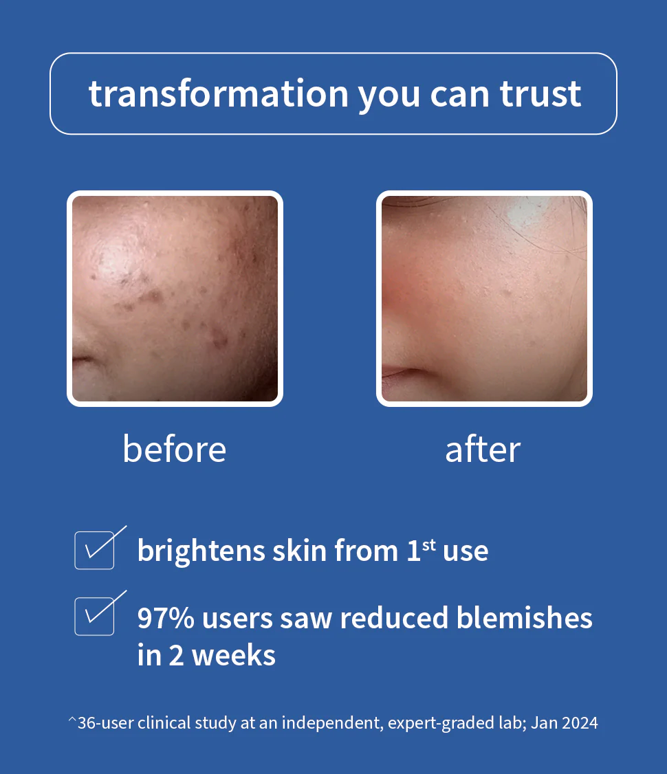 A_-All-Channel_NiaSerum_50ml_V3_02